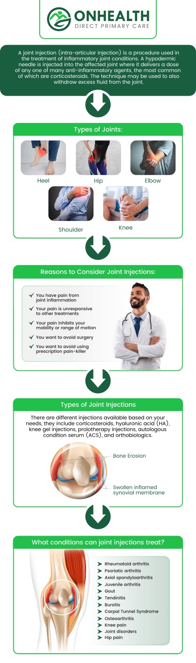 Joint injections are a vital, minimally invasive treatment that delivers targeted relief directly to the source of inflammation, offering rapid pain reduction and significantly improved mobility for those suffering from chronic joint issues or injuries. By visiting Gary Seifert, APRN, FNP-C, at OnHealth, you will receive a thorough evaluation and precise, carefully administered injections designed to safely restore your joint function and help you return to a comfortable, active lifestyle. For more information, contact us or schedule an appointment online. We are conveniently located at 11590 Black Forest Rd #10, Colorado Springs, CO 80908.