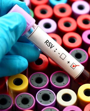 Respiratory Syncytial Virus (RSV) Test in Colorado Springs, CO