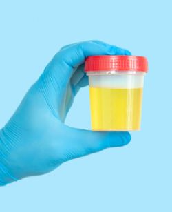 Urinalysis Treatment in Colorado Springs, CO